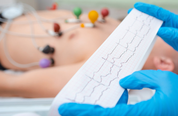 ecg-services
