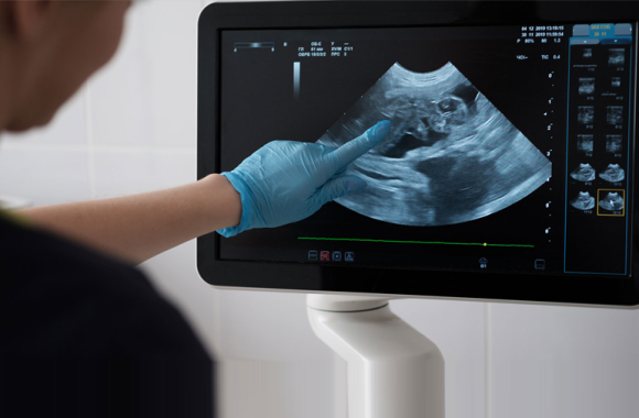ultrasound-services