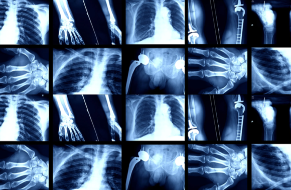x-ray-services